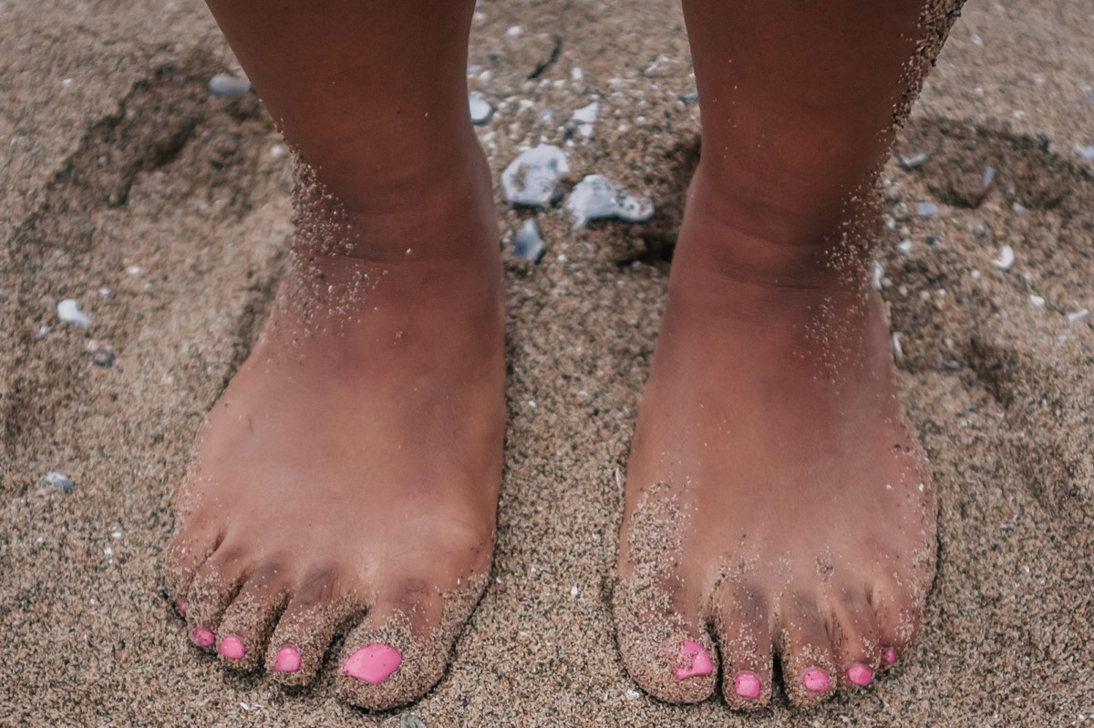 Beachies Wattsocken: Barfuß durch Watt und Strand — ohne Schnitte